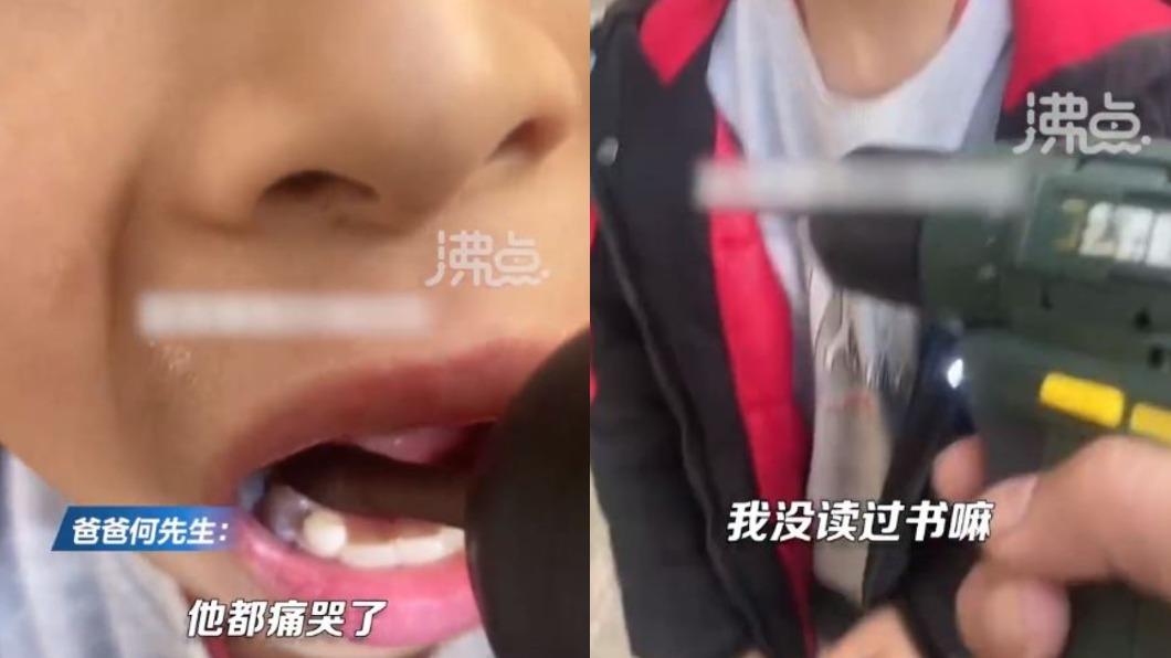何男直接掏出電鑽，朝著兒子的蛀牙鑽下去，引發各界熱議。（圖／翻攝自《沸點視頻》微博）