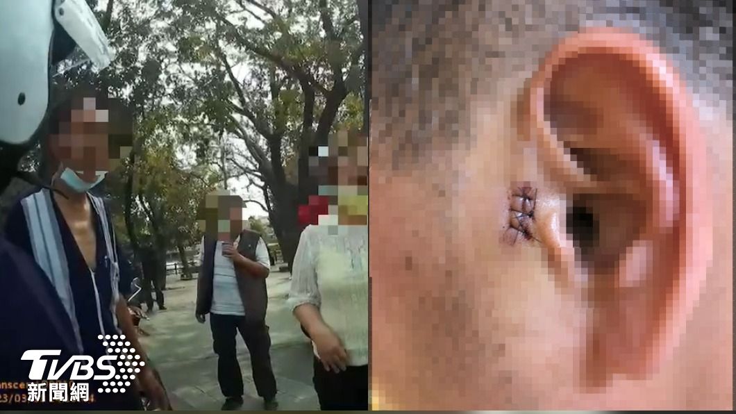 他被路霸翁持鋤頭敲腦! 警受理沒做這事被控吃案遭處分