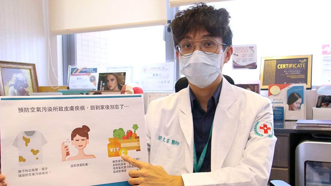 輔大醫院皮膚科主治醫師蔡文騫。（圖／醫院提供）