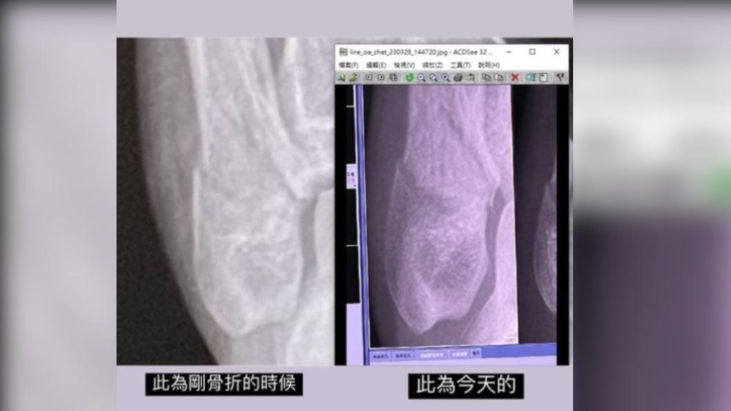 優格姐姐聽到要挖骨崩潰求救。(圖/翻攝自優格姐姐IG)