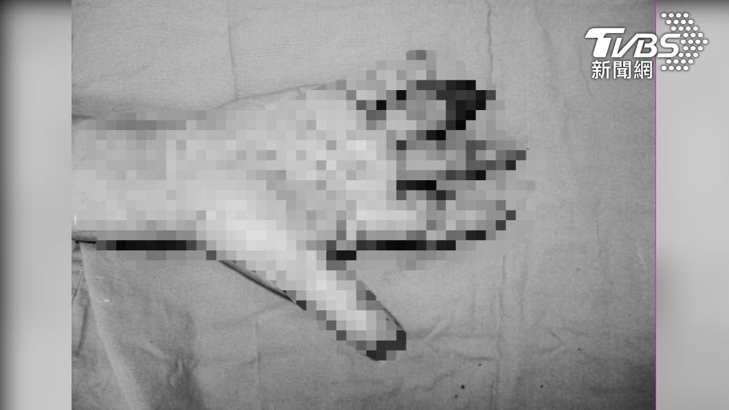 圖片來源:大林慈濟醫院提供
