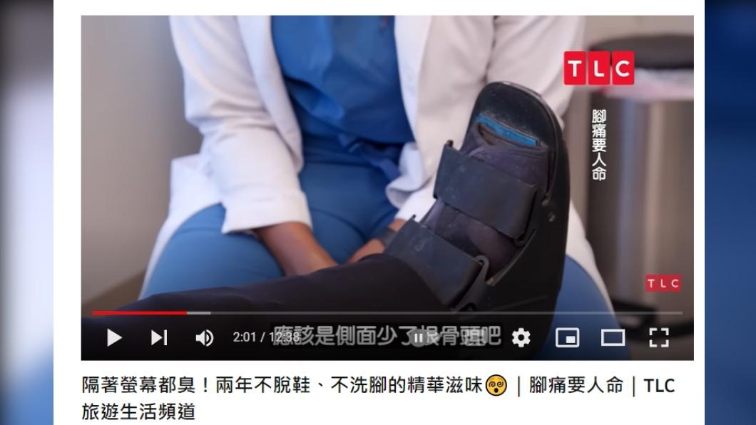 懷諾娜腳底缺一根骨頭。(圖/翻攝自TLC 旅遊生活頻道YouTube)