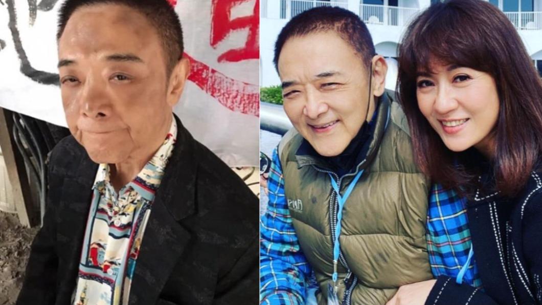 小亮哥「連環車禍」!頭傷縫9針 林姿佑驚恐還原過程