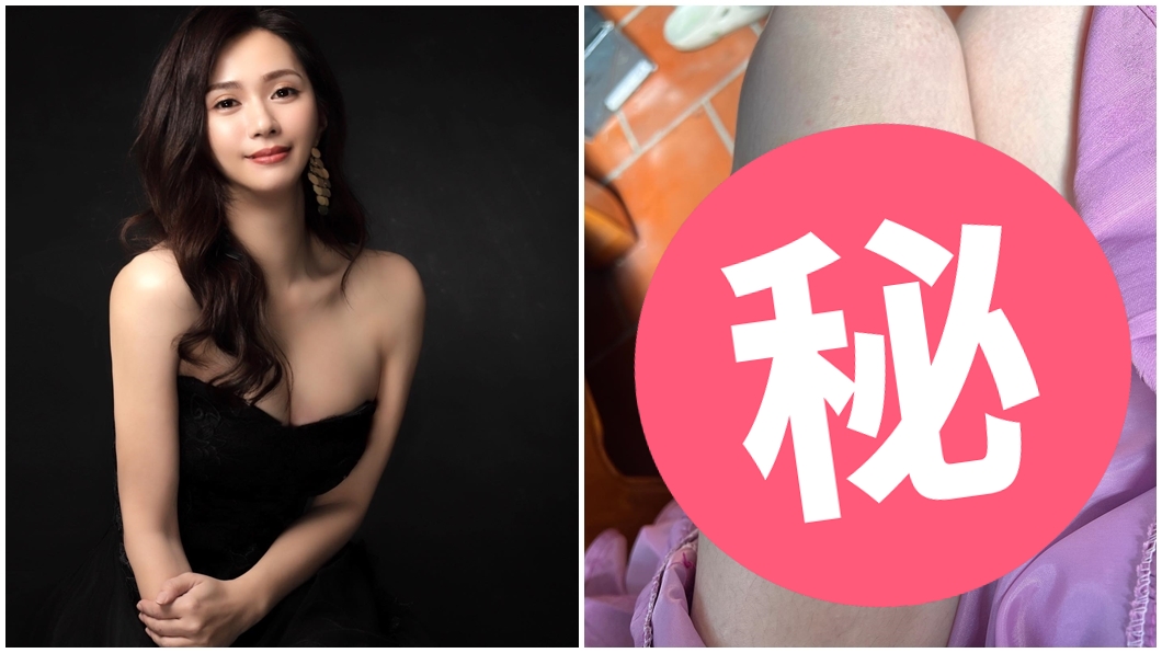 爆詭異黑青紅疹憂卡陰!八點檔女神急救醫 聽病因嚇問:會死嗎