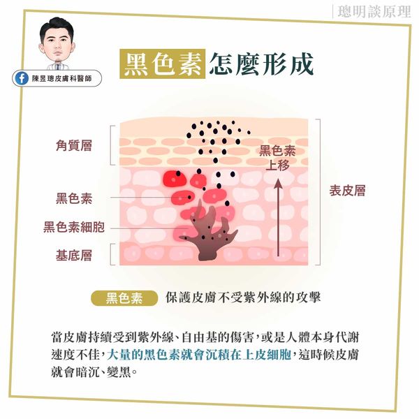 黑色素形成因素。(圖/翻攝自陳昱璁皮膚科醫師臉書)