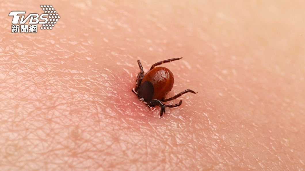 寄生蟲咬住眼睛!醫硬拔「扯離眼白」嚇壞:聽到爆裂聲