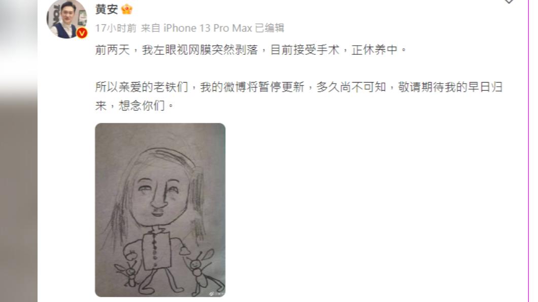 黃安發文透露左眼視網膜剝落,並宣布暫時停更微博。(圖/黃安微博)