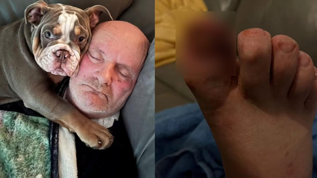 睡夢中腳趾遭愛犬咬到骨裂　男就醫驚呼：牠幫了我的忙