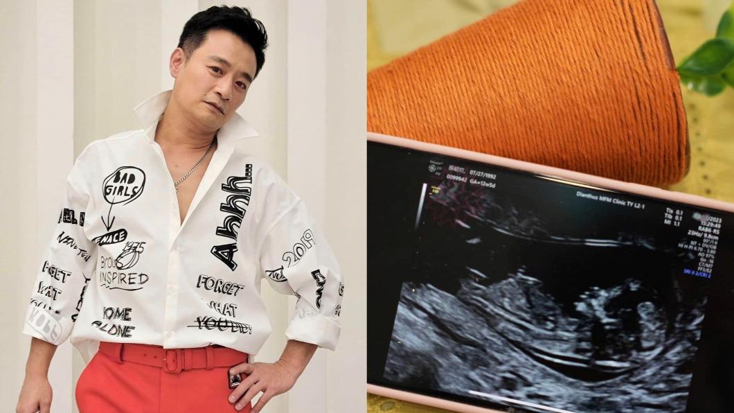 本土劇男星再當爸!備孕2年「迎真正小三」 喜曝預產期神巧合