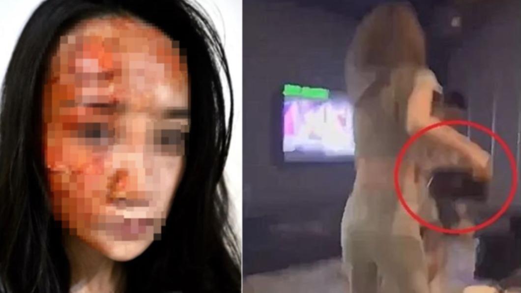 八大妹遭潑熱湯送加護！網傳「半臉毀容」照　妹子現身回應了