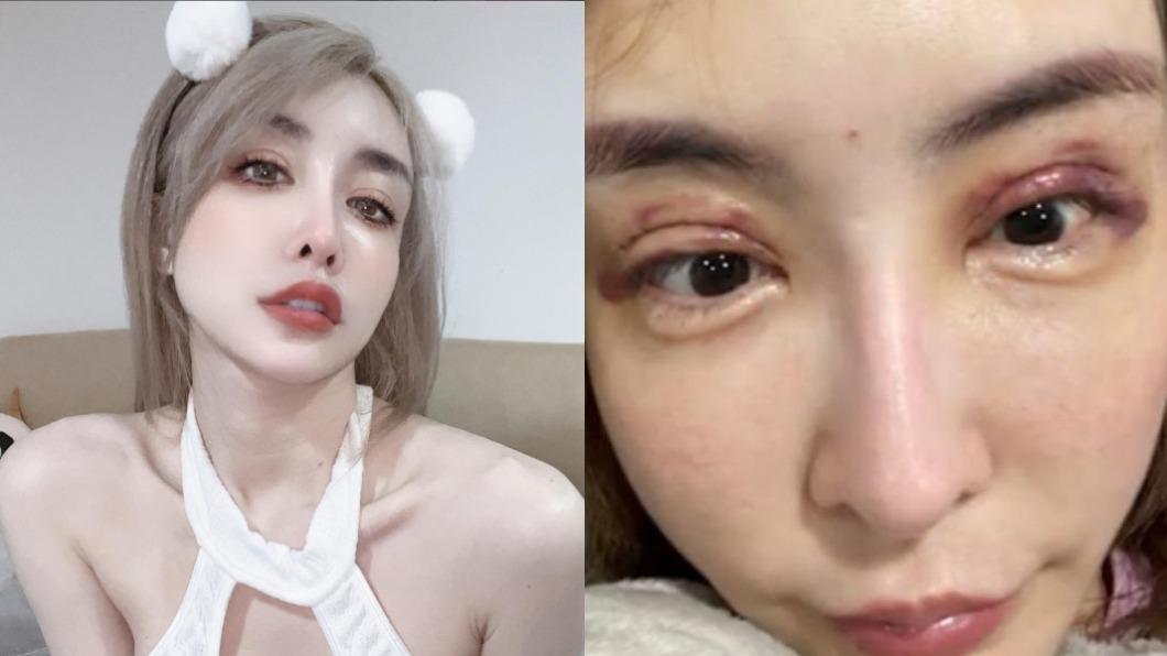 豪砸8百萬整形！情色教主「割頭皮」變臉　驚人高中嫩照出土