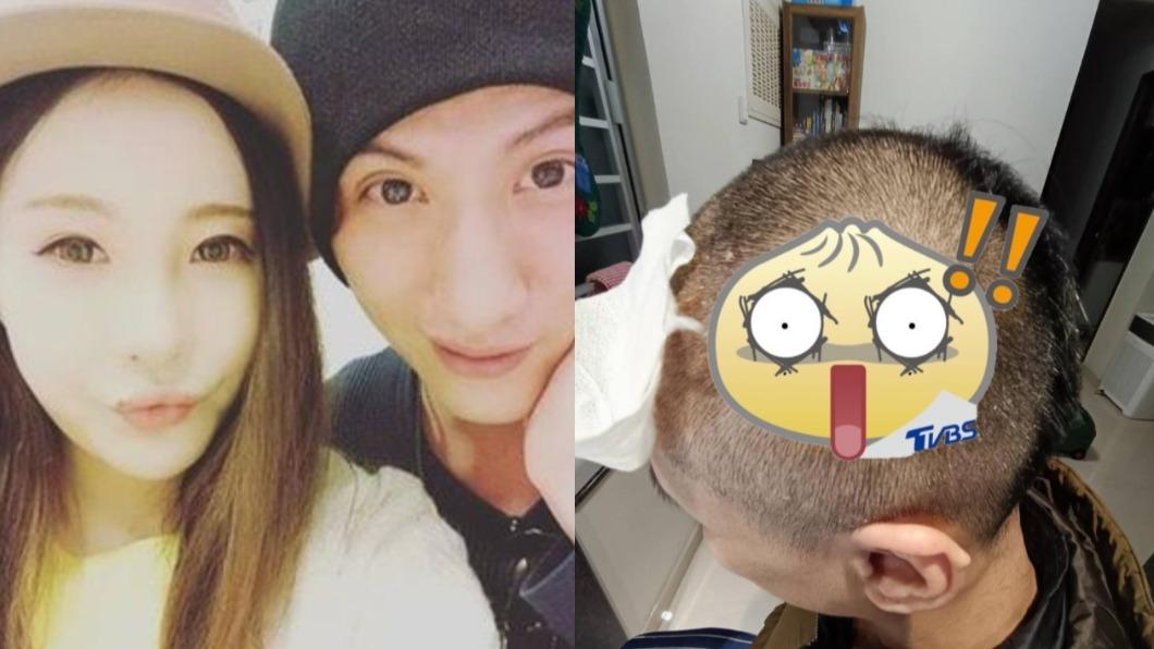 驚悚傷勢曝！「世紀賤男」歌手傳遭家暴打破頭　辣妻火大喊告