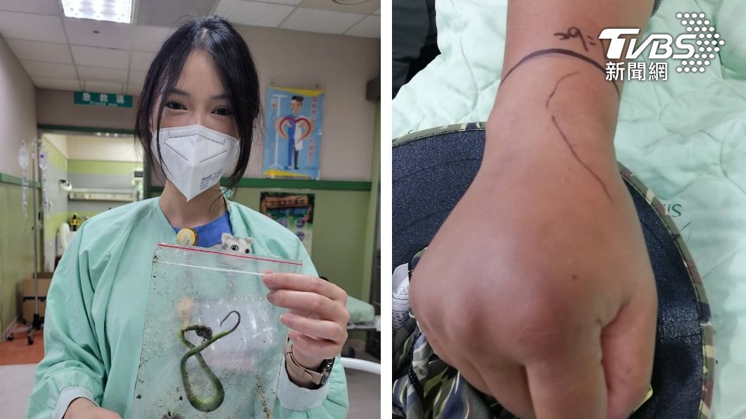採梅遭蛇吻!妙齡女手臂腫如香腸 帶「蛇屍」就醫反保命