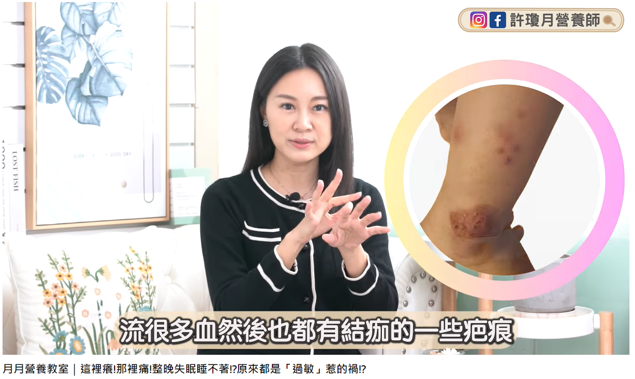 營養師許瓊月分享實際案例。(圖/翻攝自許瓊月營養師YouTube)