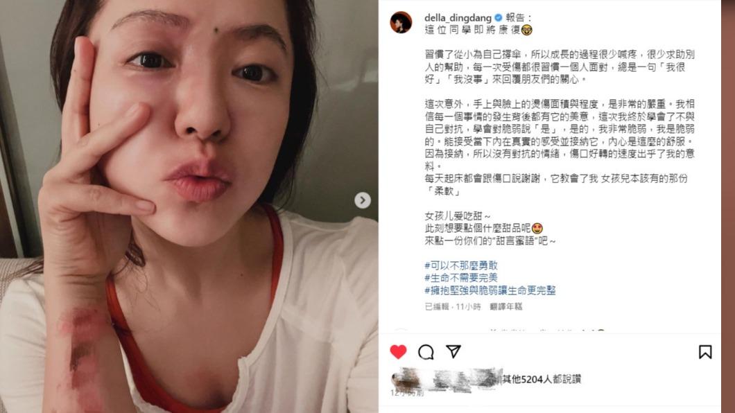 丁噹感激這次的意外,讓她學會接受內心脆弱的一面。(圖/翻攝自丁噹IG)