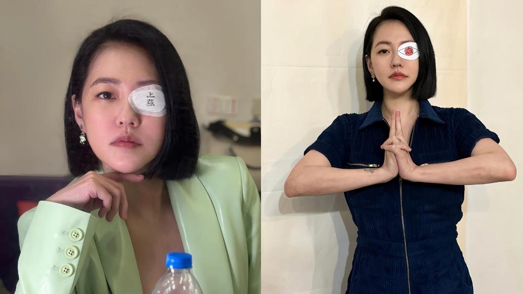 小S眼睛受傷，趁機玩起動漫人物Cosplay。（圖／翻攝自小S臉書）
