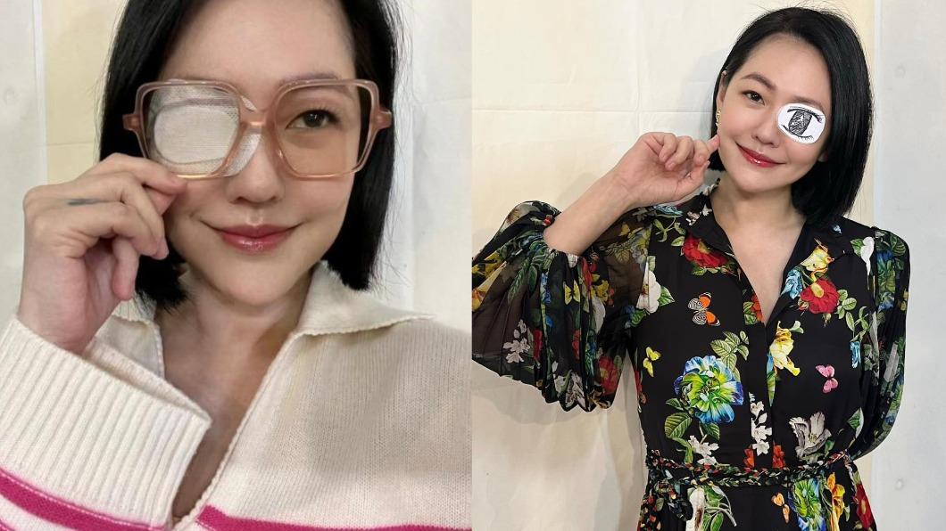 小S好瘋!眼睛意外刮傷反俏皮 喬裝「知名動漫人物」網笑翻