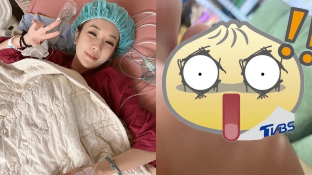 才大出血躺7天!本土劇惡女曝「腳趾全黑」照 嘆:走路都困難