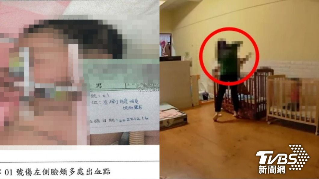 3天狂摔14次!8個月男嬰永久腦傷 惡保母急刪監視器滅證