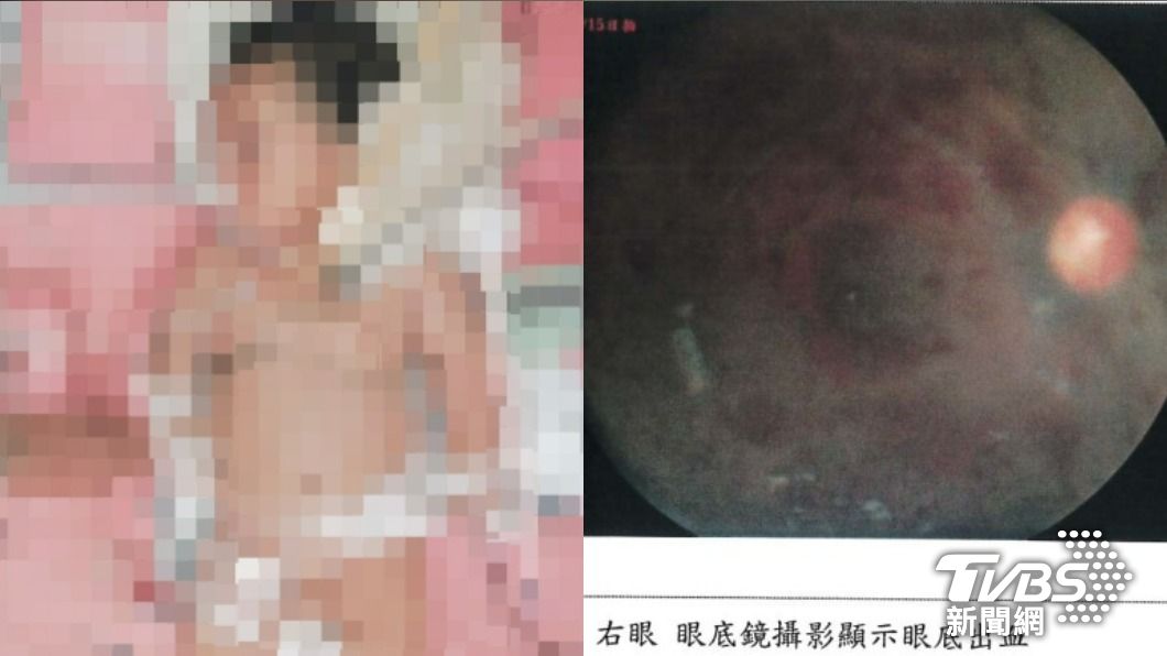 男嬰永久腦傷。(圖/民眾提供)