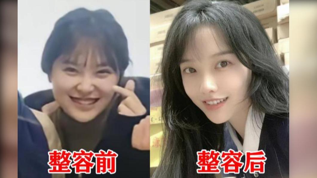 黃老師被網友挖出過往照片與現今判若兩人,疑似有進場維修。(圖/翻攝自北京頭條微博)