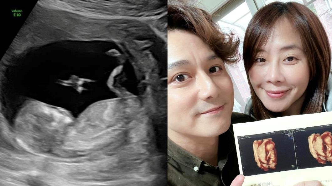 恭喜！廖科溢宣布當爸　結婚5月喜曬寶寶超音波：老婆辛苦了