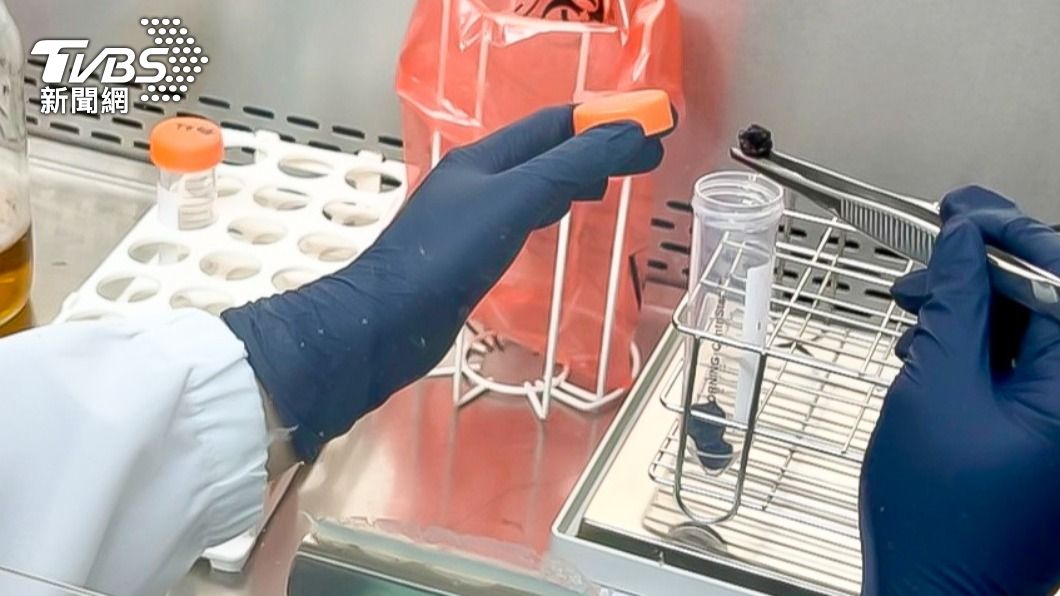 食藥署表示A肝病毒檢驗流程耗時。（圖／食藥署署提供）