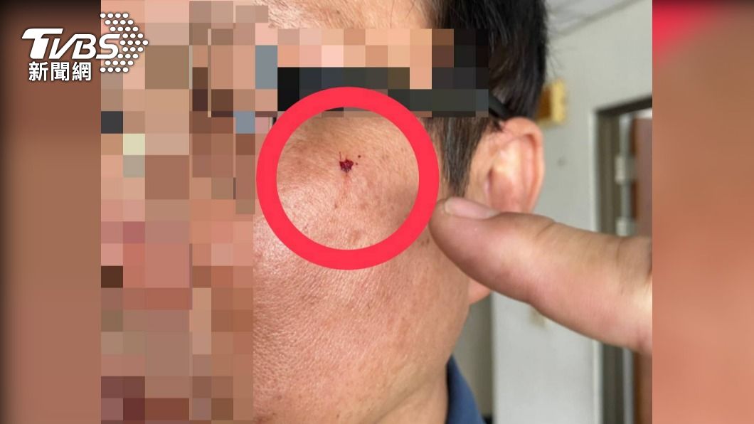 不爽被開單!男騎檔車闖國道還襲警 小隊長臉部慘「破相」