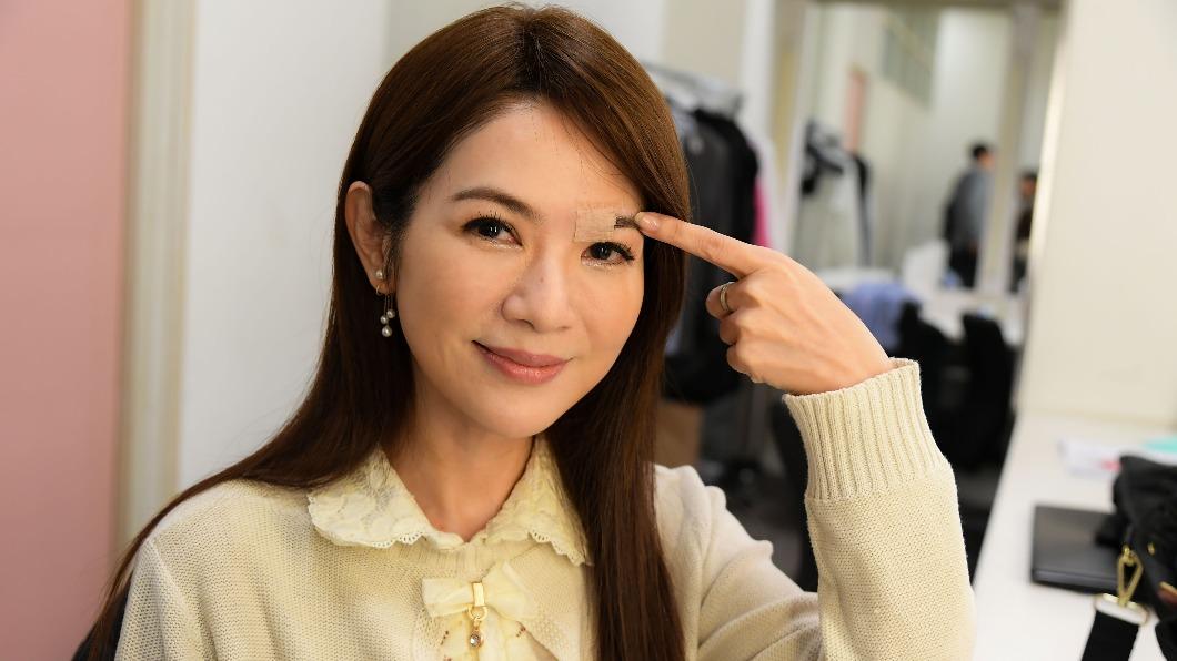 八點檔女星爆意外!「當場破相血流不止」 驚悚受傷照曝光