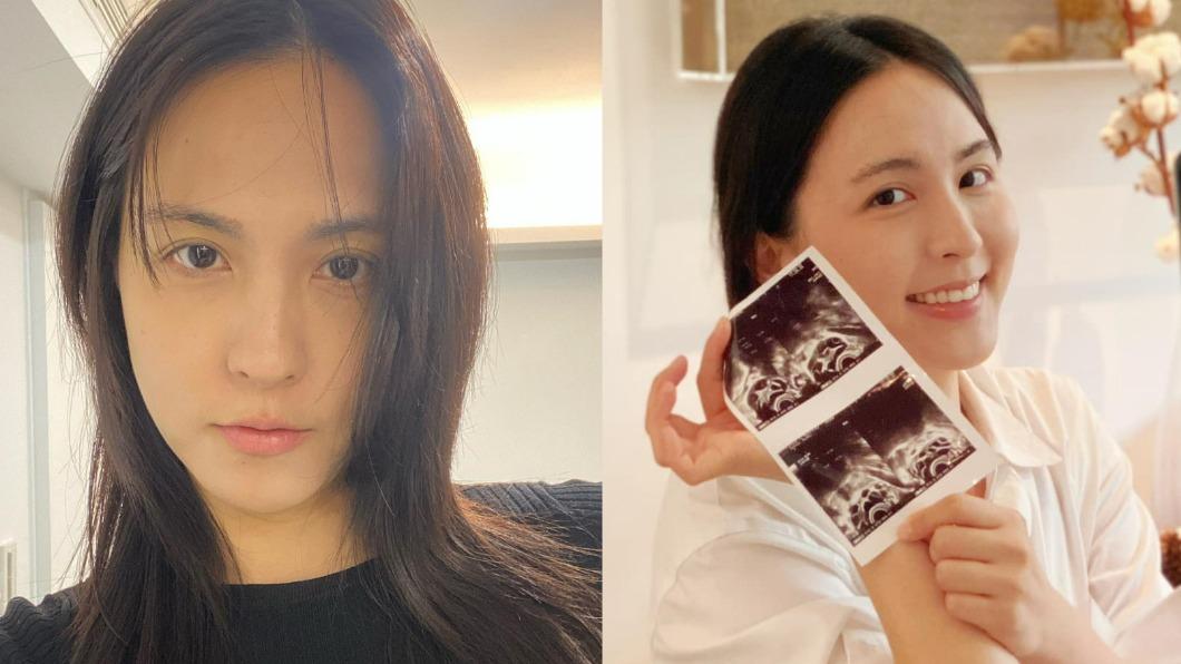 38歲魏蔓突曬「超音波照」! 噴母愛喊:用行動力在愛他