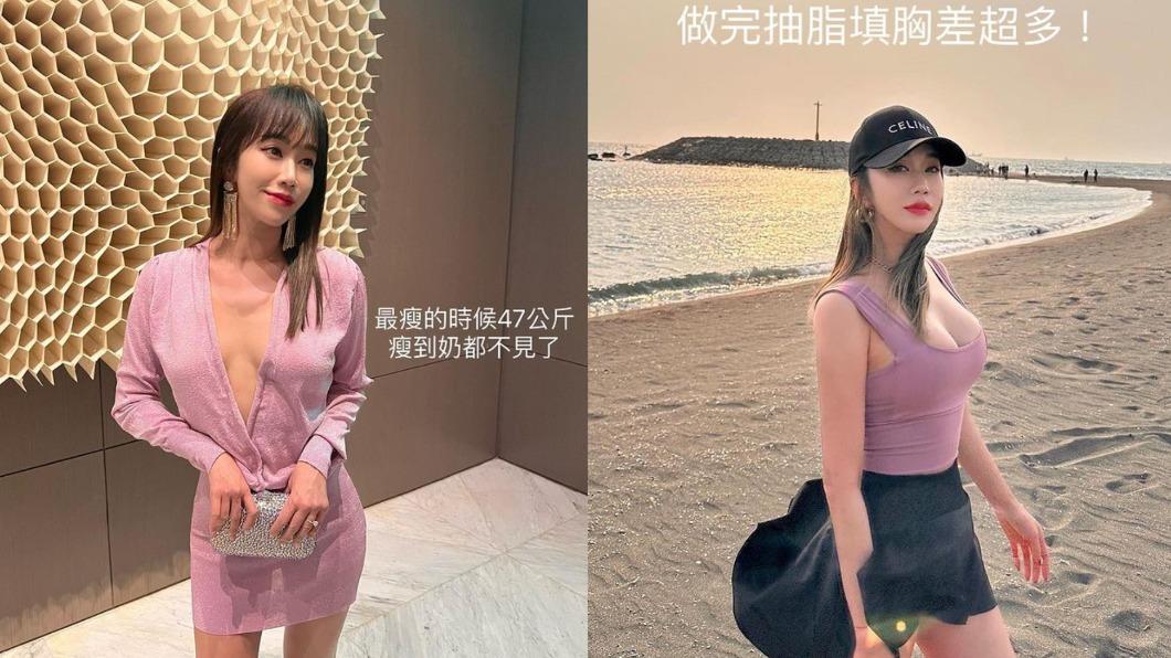 林佩瑤在經過謹慎思考後,仍冒著風險進行抽脂隆胸手術。(圖/翻攝自林佩瑤IG)