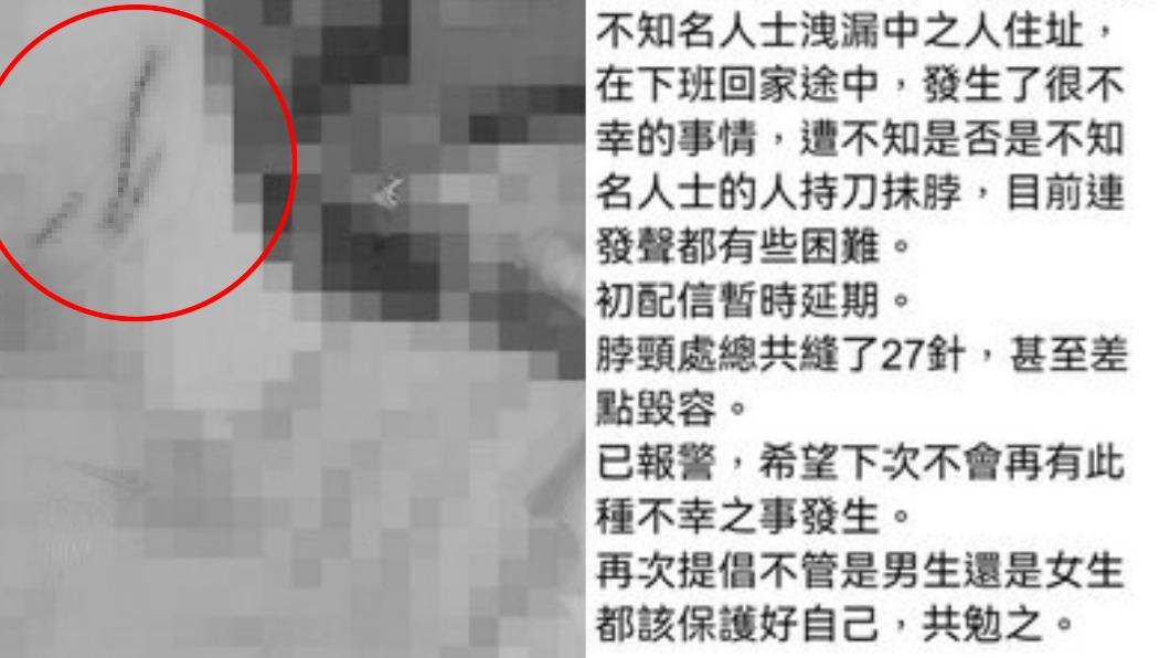網路發文「被割喉縫27針」 警火速約談女子戳謊送辦