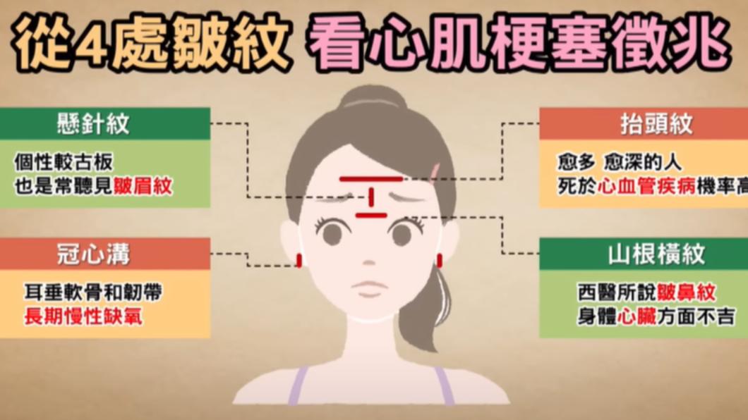 臉上4處皺紋恐是心血管疾病警訊。(圖/翻攝自健康2.0 YouTube)