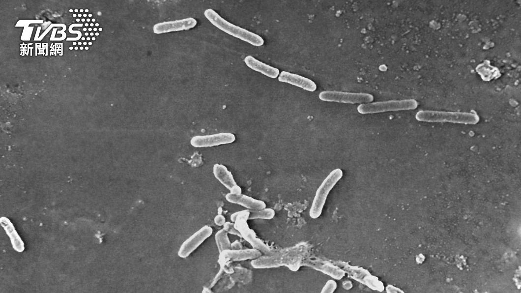CDC指出，感染源為綠膿桿菌。（圖／達志影像美聯社）