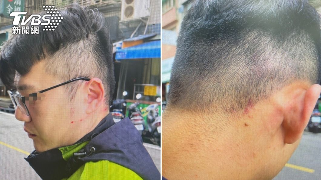 兩名警員的臉部、後腦都有挫傷,其中1人還有輕微腦震盪。(圖/TVBS)