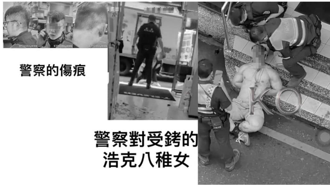 有網友作圖比對兩方傷勢。（圖為網友合成／翻攝自朱學恒的阿宅萬事通事務所臉書）