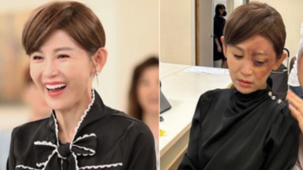 本土劇一姐「緊急送醫」停拍!昏厥慘坐輪椅 1天只睡3小時