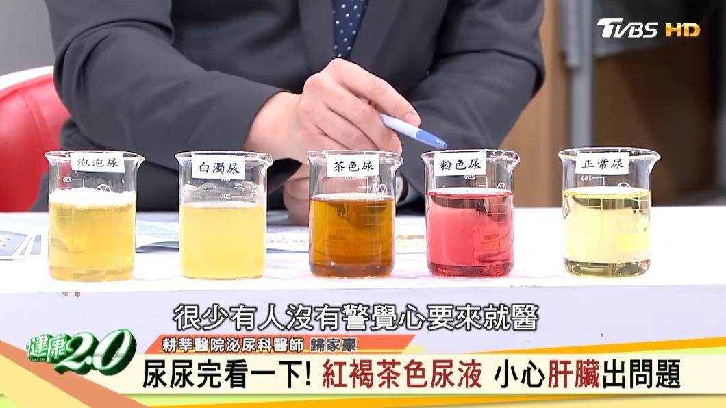 尿液若出現4種顏色,恐是身體警訊。(圖/翻攝自《健康2.0》YouTube)
