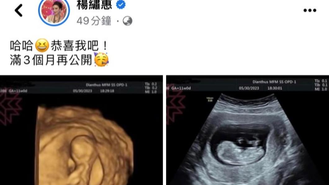楊繡惠突然曬出超音波。（圖／翻攝自楊繡惠臉書）