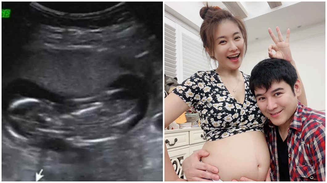 44歲女星懷第三胎！猛讚「尪太強」　以為更年期靠1招再懷胎