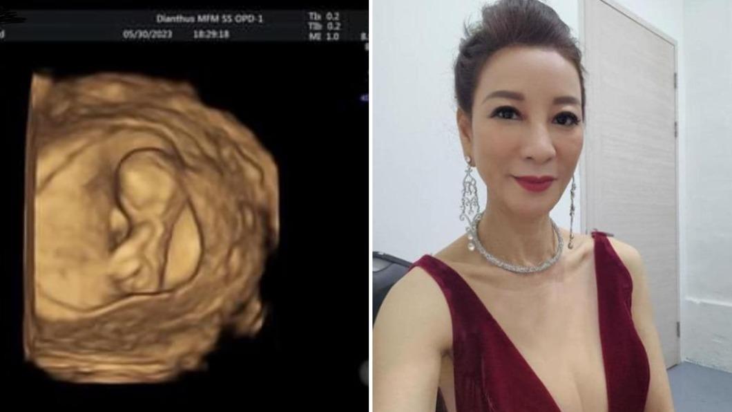 58歲楊繡惠嗨曝超音波！　人夫男星突驚語：去一趟就…