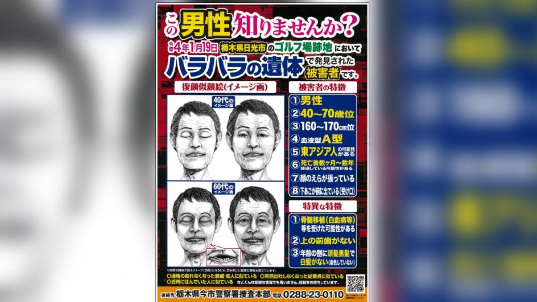 警方指出，死者可能進行過骨髓移植。（圖／翻攝自推特）