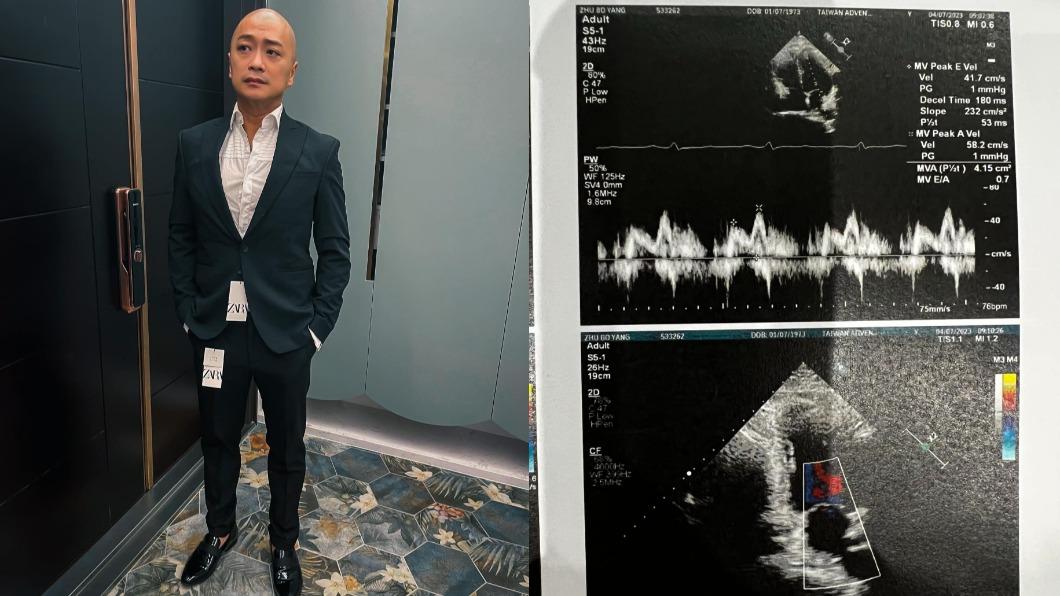 跟劉真同病!男星被提醒檢查 竟長主動脈瘤「少一片心臟瓣膜」