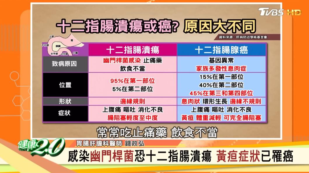 十二指腸癌、十二指腸潰瘍致病原因不同。（圖／TVBS《健康2.0》）