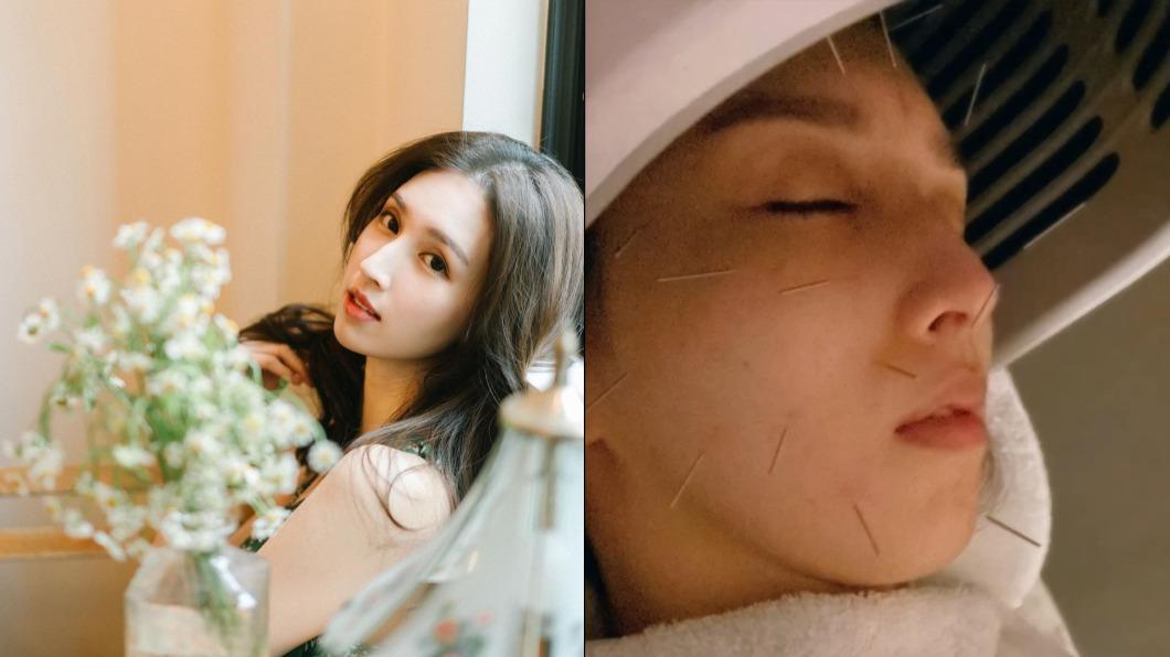 甜美女星病了！消失3個月認失去知覺突「面癱」　病態模樣曝