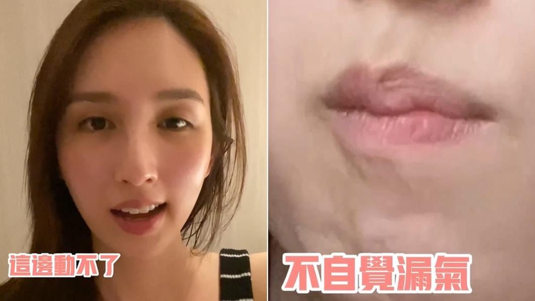 何天兒第七條交叉神經線出問題,會不自覺漏氣。(圖/翻攝自misslilyho IG)