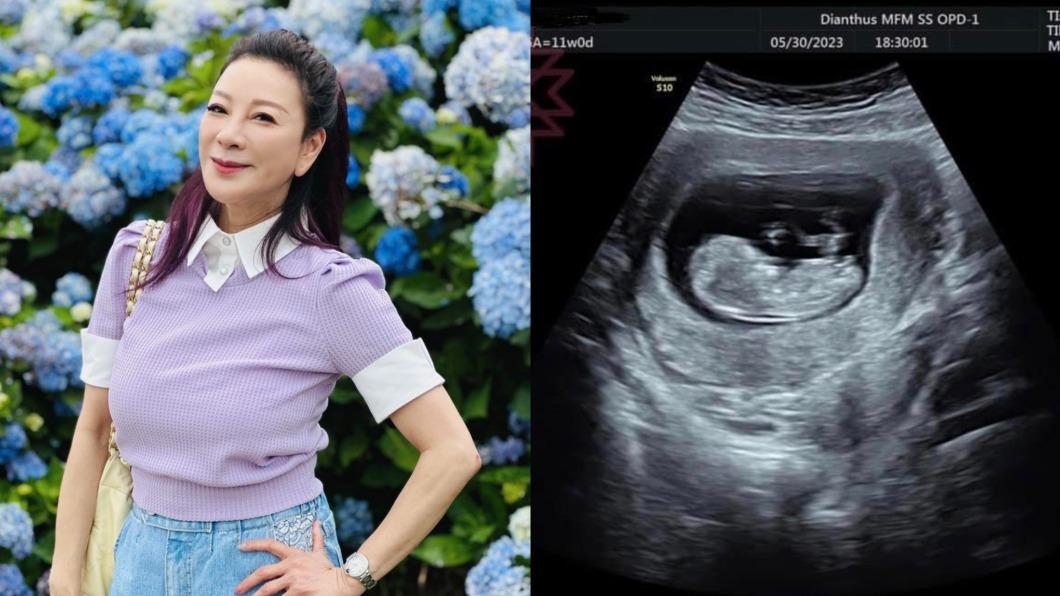 真的曝光了!楊繡惠曬超音波照迎新身分 喜揭「孩子爸」是他