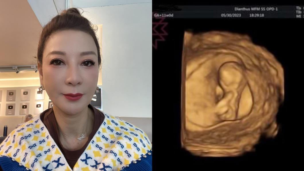 楊繡惠透露超音波照片是她親姊姊的小兒子的孩子,自己將升格姨婆。(圖/翻攝自楊繡惠臉書)