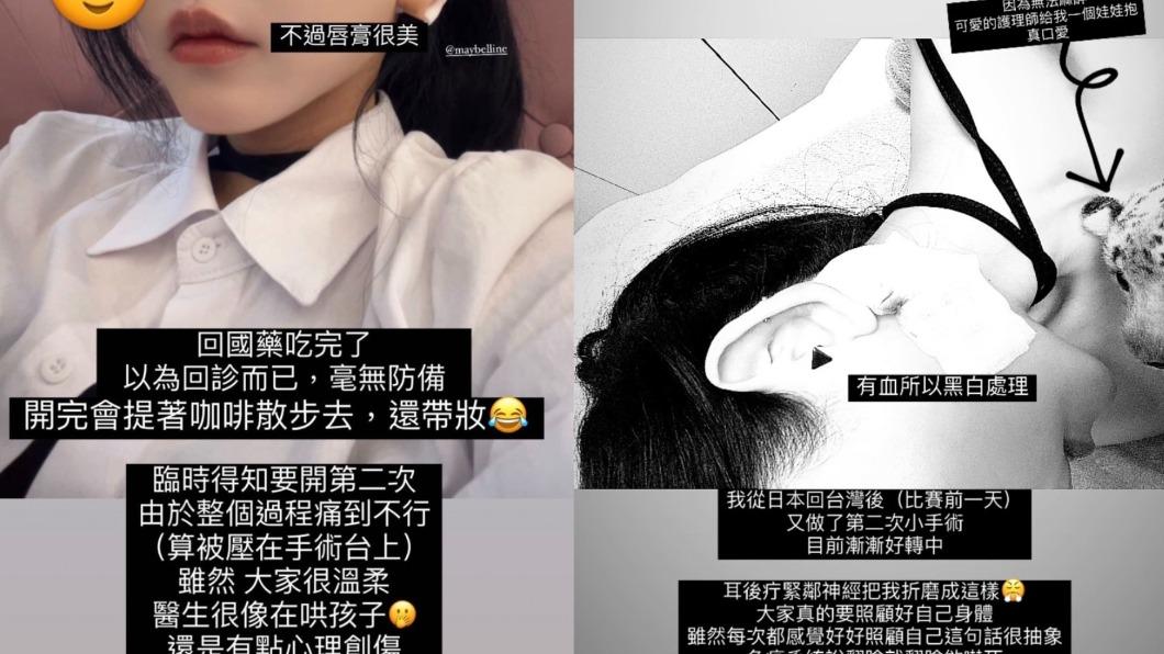許允樂分享回診突然被抓上手術台的經驗。(圖/翻攝自@byleway IG)