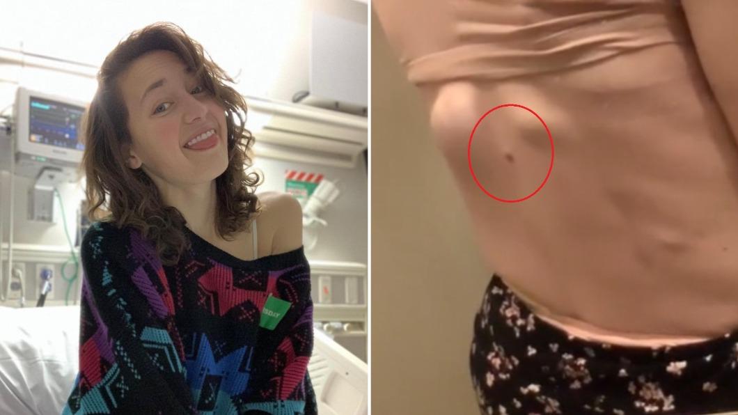 美國網紅皮爾森18歲發現長出形狀不對稱的痣，最終不幸病逝。（圖／翻攝自抖音、kassidypierson IG）